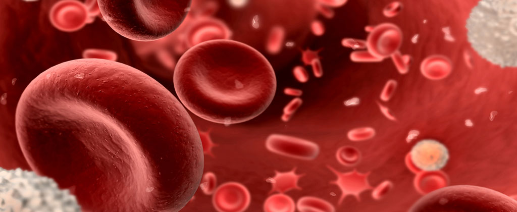 Curing High Blood Pressure