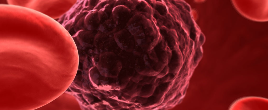 Getting To Grips With Cancer