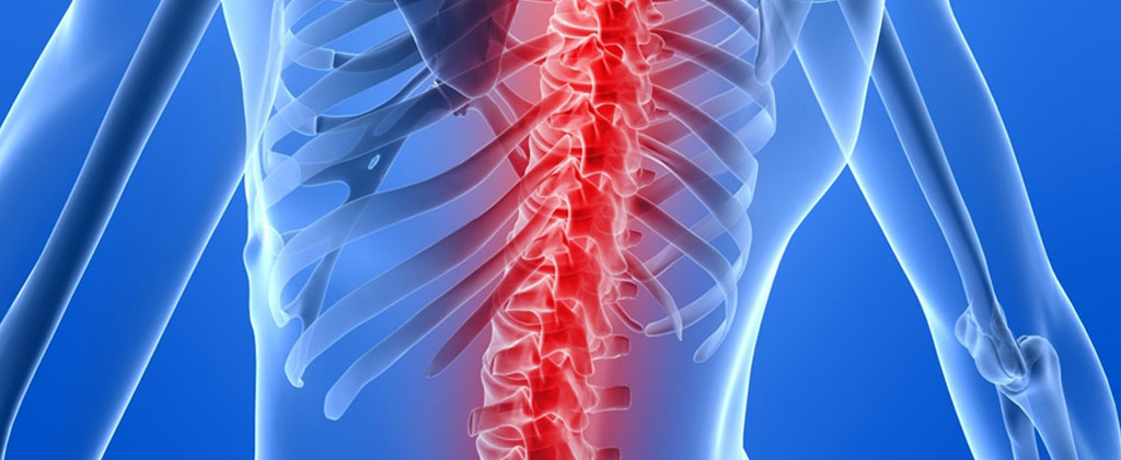 What you Can Do About Osteoporosis
